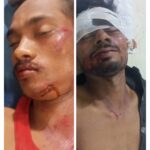 बहरागोड़ा: सड़क दुर्घटना में दो युवक घायल, बारीपदा रेफर